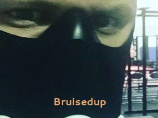 Bruisedup